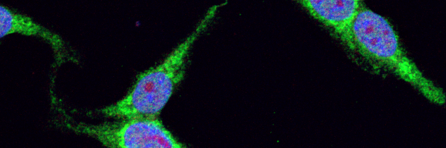 Identificirali proteinske interakcije povezane z nevrodegenerativnimi  boleznimi