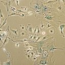 Prof Jürgen Dittmer:»Tumor-stroma interactions in breast cancer«