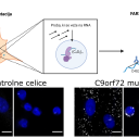 Novo odkritje v raziskovanju vzrokov amiotrofične lateralne  skleroze in frontnotemporalne demence